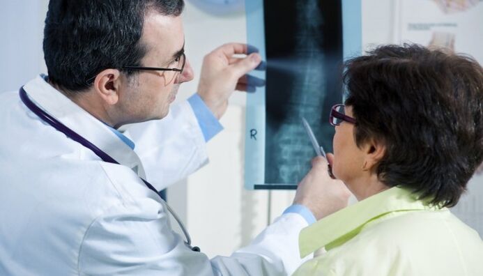 radiografía da columna vertebral con osteocondrose