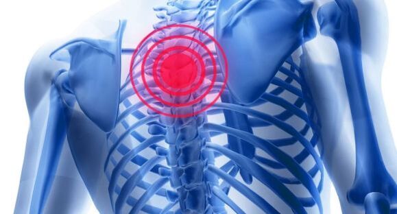 Tratamento da osteocondrose da columna torácica