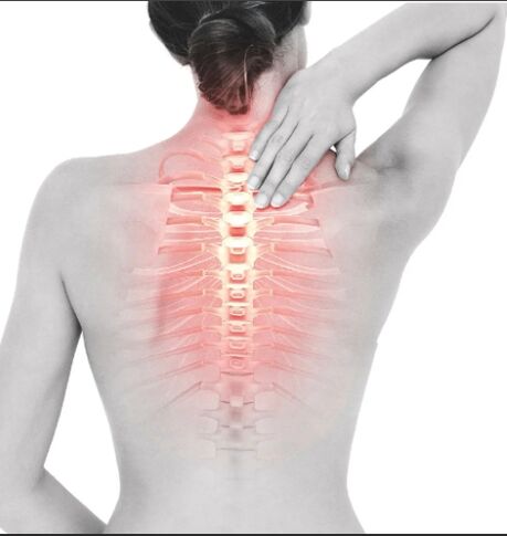 Osteocondrose da rexión torácica
