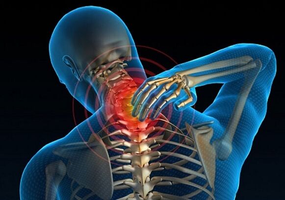dor no pescozo debido á osteocondrose