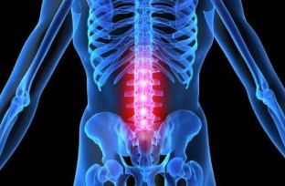 Vertebral osteocondrose